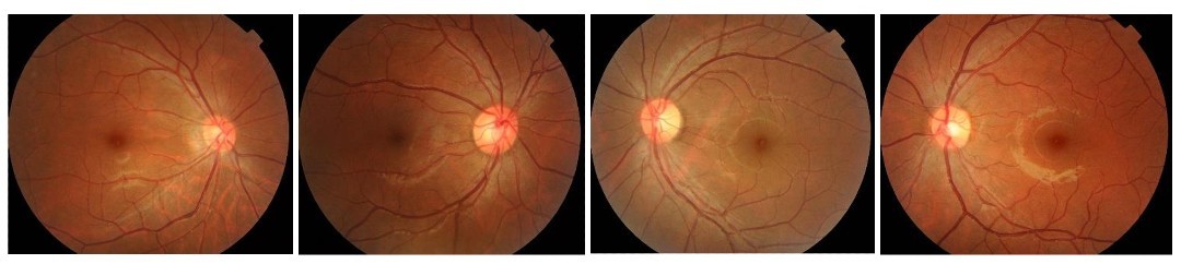 Fundus